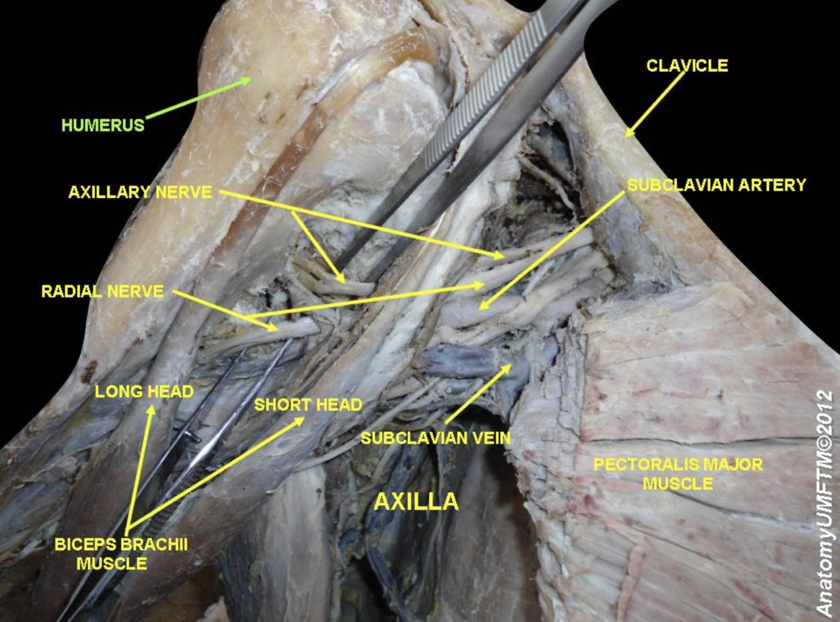 Humerus Anatomy: Cadaver View of the Upper Arm