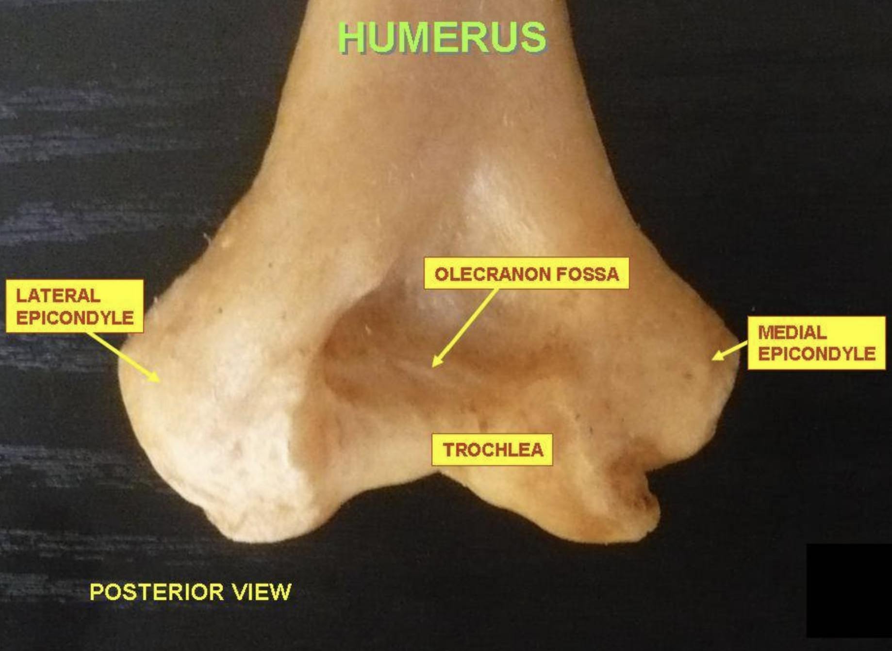 Trochlea of Humerus: Posterior View Anatomy