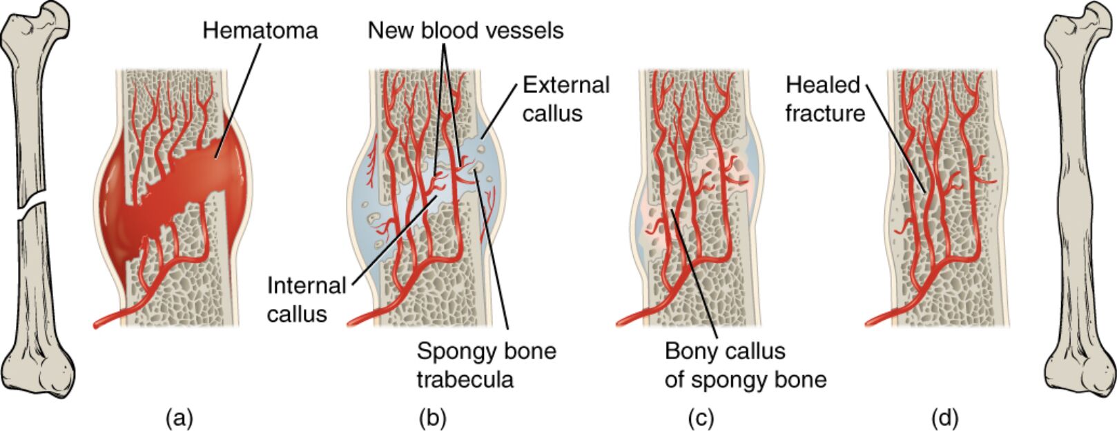 Stages of Fracture Repair: A Detailed Diagram and Guide to Bone Healing