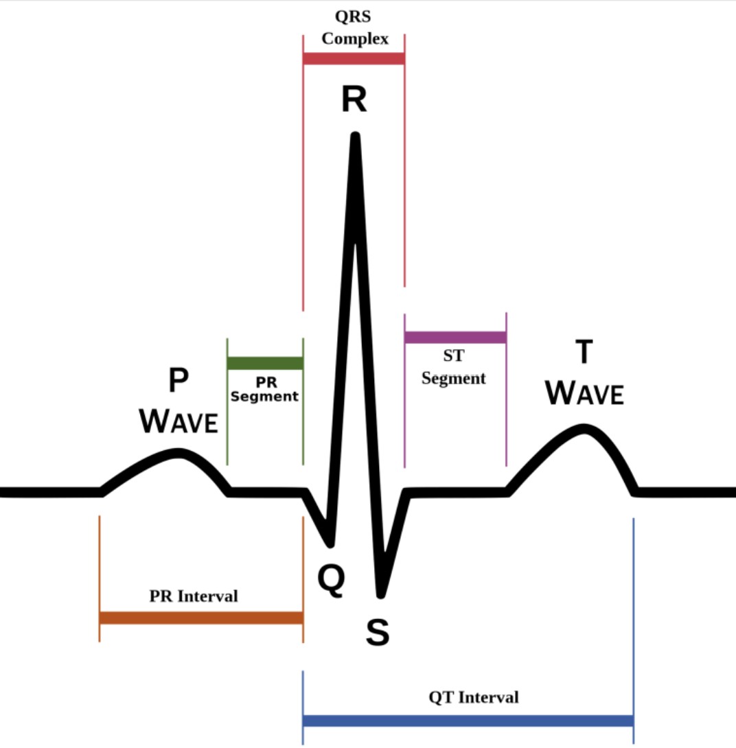EKG QTc Calculator