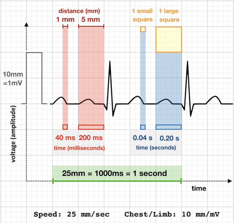 EKG QTc Calculator